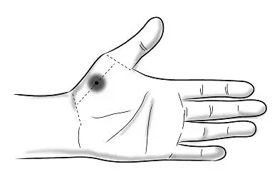 _2